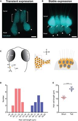 Tmc Reliance Is Biased by the Hair Cell Subtype and Position Within the Ear
